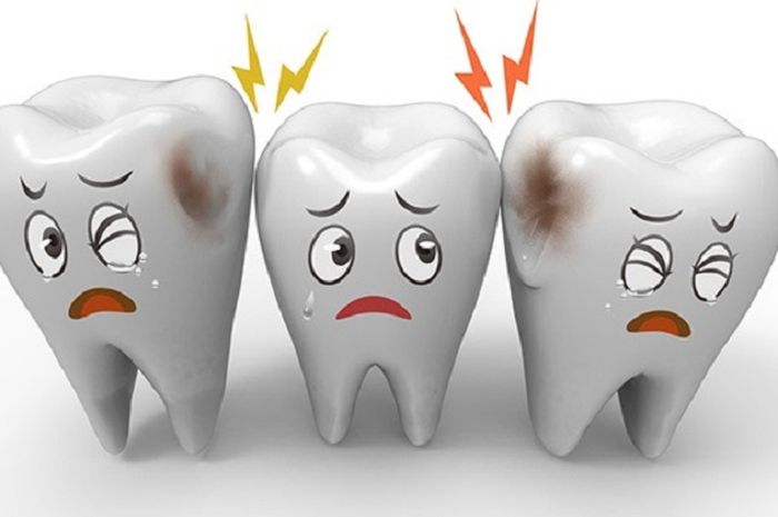 Tak Tahan dengan Rasa Sakit  Gigi  Redakan dengan 4 Cara 