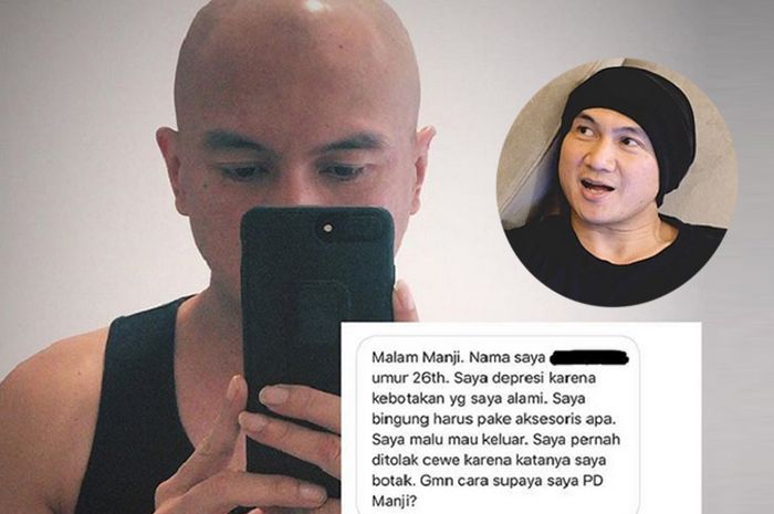 Dicurhati Cowok Botak Anji Bagikan Saran Tampil Percaya Diri Tanpa Sehelai Rambut