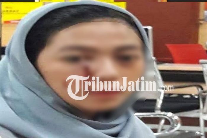 Korban Kasus Penganiayaan Saddil Ramdani, Anugrah Sekar Rukmi