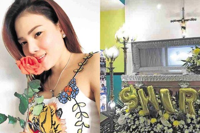 Shiryl Saturnino meninggal dunia setelah menjalani operasi plastik