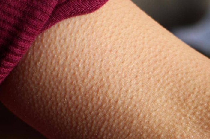 Merinding Ketika Dengar Lagu Tertentu, Penelitian Ungkap Adanya Tanda