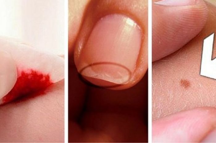 Jangan Sepelekan! Jika 5 Gejala Ini Muncul pada Tubuh, Segera Kunjungi