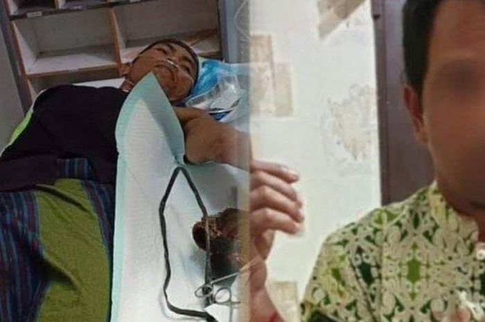 Gara-gara pegang alat kelamin kakak iparnya, Ahmad harus kehilangan tangan kirinya yang setelah ditebas suaminya dengan parang.