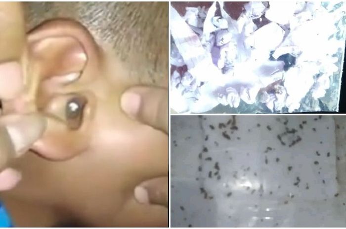 Viral Telinga Bocah Di Majalengka Kemasukan Potongan Kertas Ribuan Serangga Seperti Ini Cara Mengeluarkan Dan Risikonya Semua Halaman Grid Health
