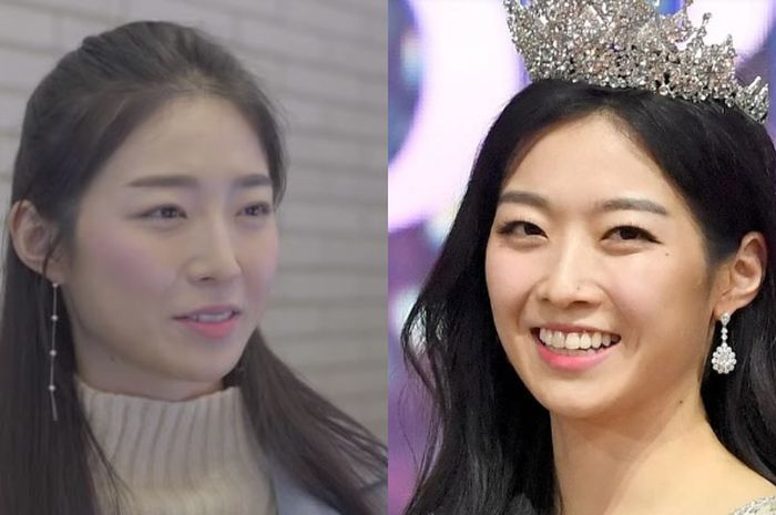 Dibully Masyarakat Karena Dianggap Terlalu Gemuk Miss Korea 2018 Ungkap Sisi Gelap Ajang Kecantikan Negara Tersebut