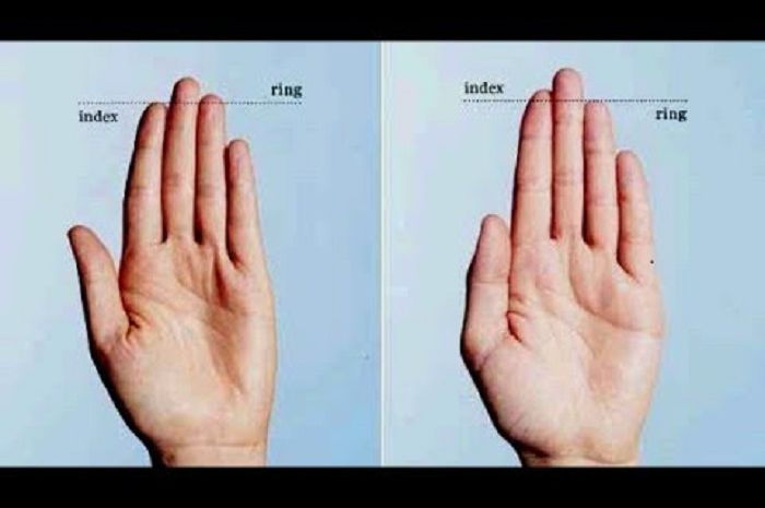 Gambar Tangan Di Infus Asli Perempuan