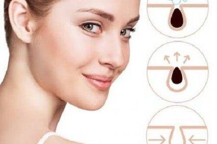3 Cara Mengatasi Pori Pori Yang Tersumbat Yuk Ikuti Tips Berikut Semua Halaman Intisari