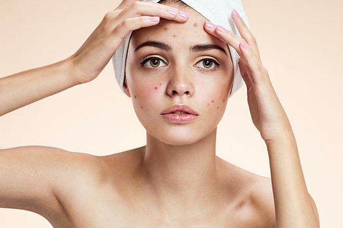 Tanda produk skincare tidak cocok