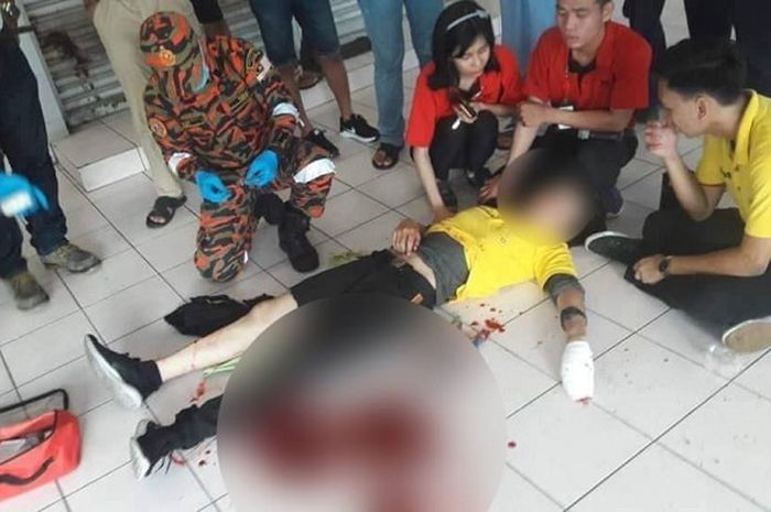 Gara-gara selfie, pria ini ditebas orang asing.