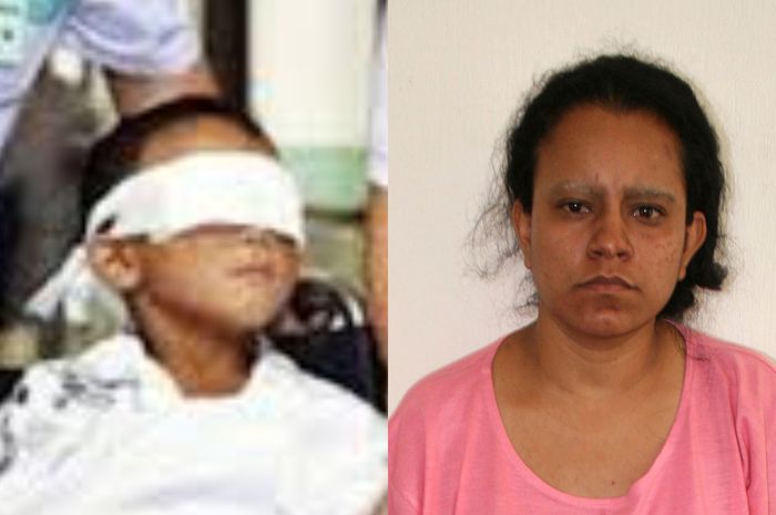 Mata anak ini dicongkel oleh ibunya sendiri