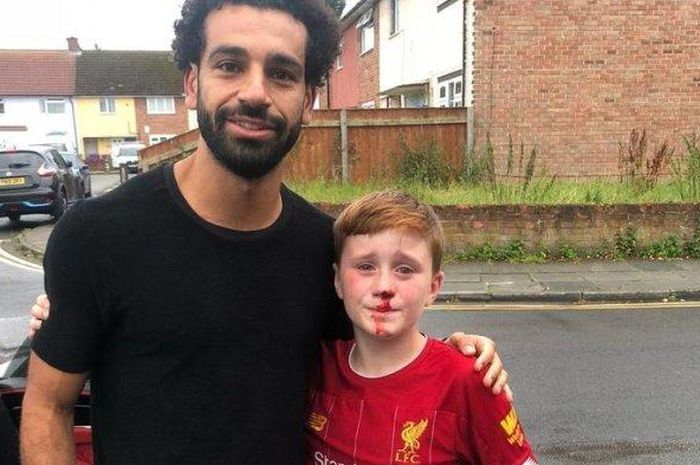 Pemain Liverpool, Mohamed Salah, menemui seorang fan yang hidungnya berdarah.