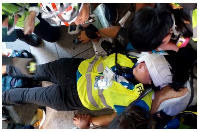 Veby Mega Indah, wartawan Indonesia yang tertembak saat meliput demo Hong Kong.