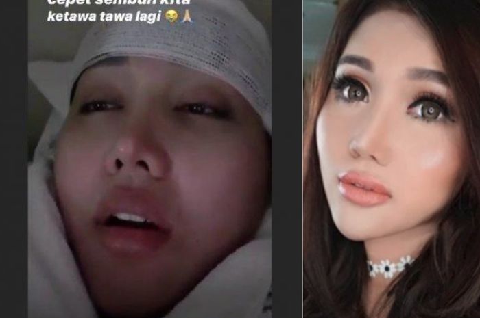 Vdio Bokep Lucinta Luna - Dikabarkan Alami Kecelakaan, Musuh Bebuyutan Lucinta Luna Sebut ...