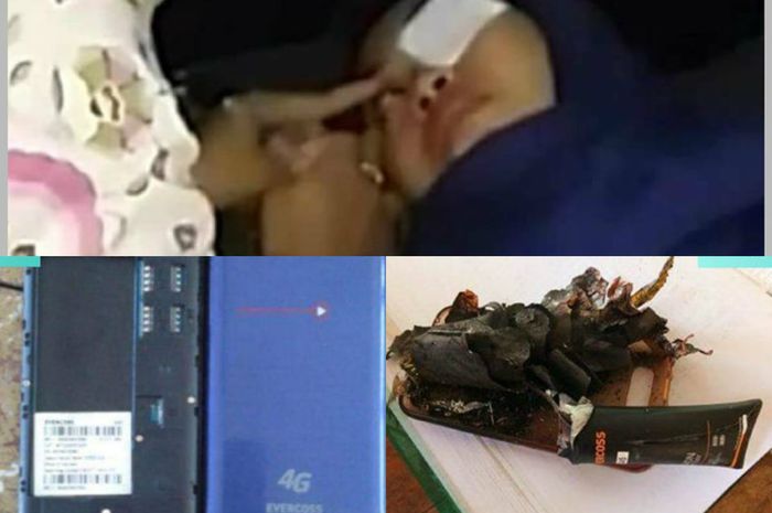 Handphone yang disimpan di meja tiba-tiba meledak, melukai mata salah seorang siswi kelas XII MAN Ciamis