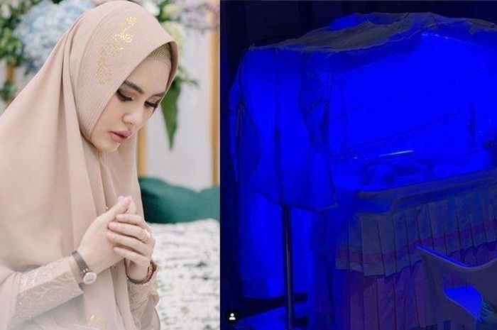 Bayi Kartika Putri Terkena Penyakit Kuning, Apa Penyebab ...