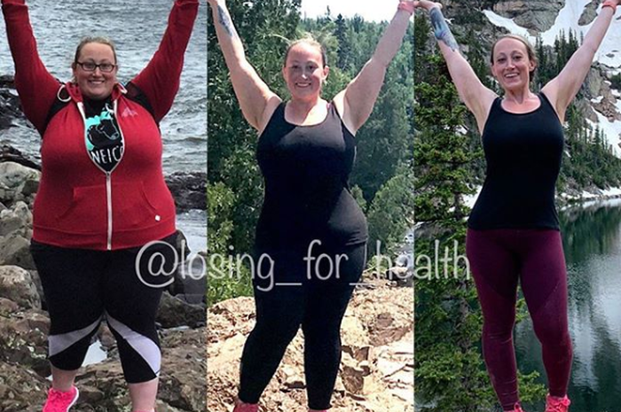 Stacy Blair sebelum dan sesudah turunkan berat badannya.