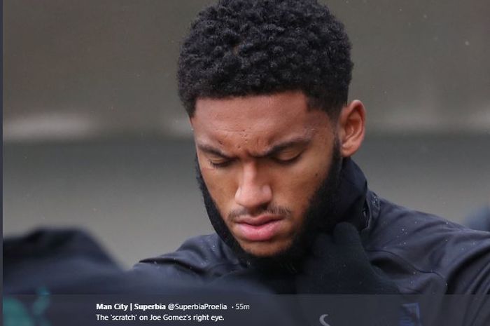 Bek tengah timnas Inggris, Joe Gomez, berlatih dengan bekas luka setelah berkelahi dengan Raheem Sterling.