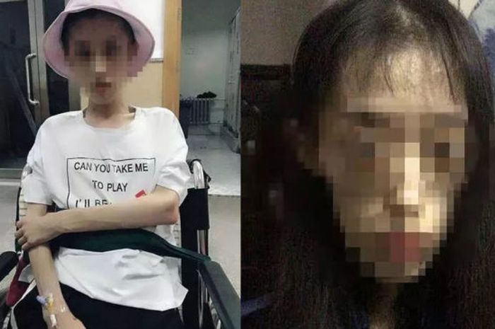 Wanita yang menjalani diet ketat.