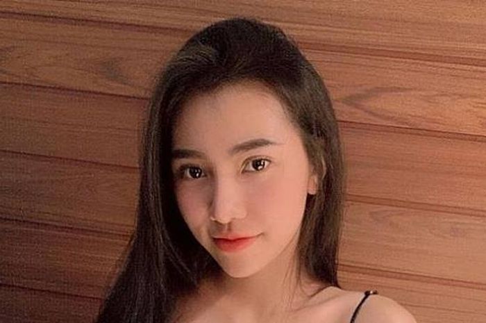 Vu Van Anh asal Vietnam setelah operasi plastik