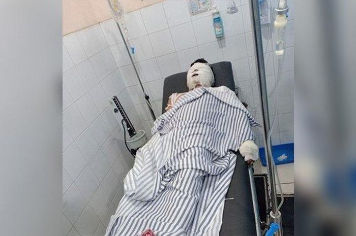 Modus Perampokan Baru! Janjian Bercinta di Hotel, Pria Asal Karawang Ini Justru Dipukuli dan Dibakar Hidup-hidup
