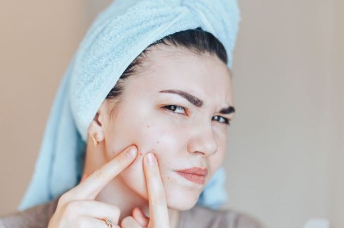 Cara Mengatasi Fungal Acne Ini Tips Skincare Yang Harus Kamu