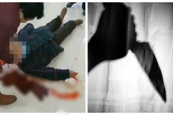 Brutal, Wanita 71 Tahun dan Seorang Anak sampai Ditusuk Orang di Tengah