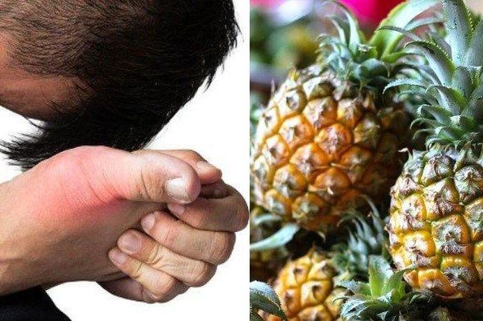 Ampuh Atasi Asam Urat Coba Ramuan Nanas Dan Madu Berikut Ini Simak Cara Membuatnya Semua Halaman Hype Ampuh Atasi Asam Urat Coba Ramuan Nanas Dan Madu Berikut Ini Simak Cara Membuatnya Semua Halaman Hype