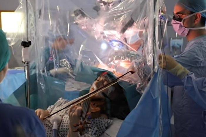 Video Saat Tengkoraknya Sedang Dibedah Dan Dokter Berusaha Pertahankan Syaraf Otaknya Tetap Aktif Wanita Ini Tampak Khidmat Bermain Biola Di Ranjang Operasi