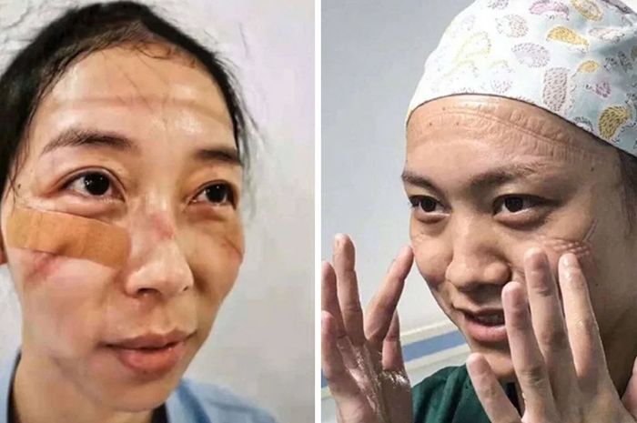Kolase kondisi perawat di China