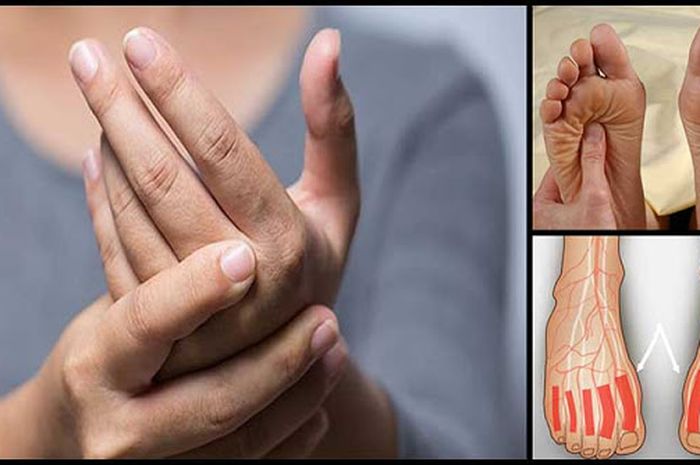 Menghentikan Neuropati Agar Tak Menjadi Lebih Buruk Halaman All Kompas Com