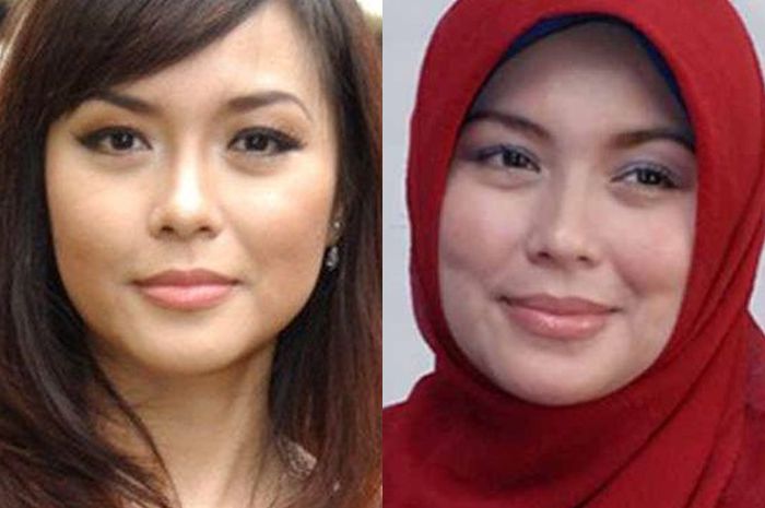 Tumor Otak Renggut Nyawa Artis Sinetron ini di Usia Muda, Siapa