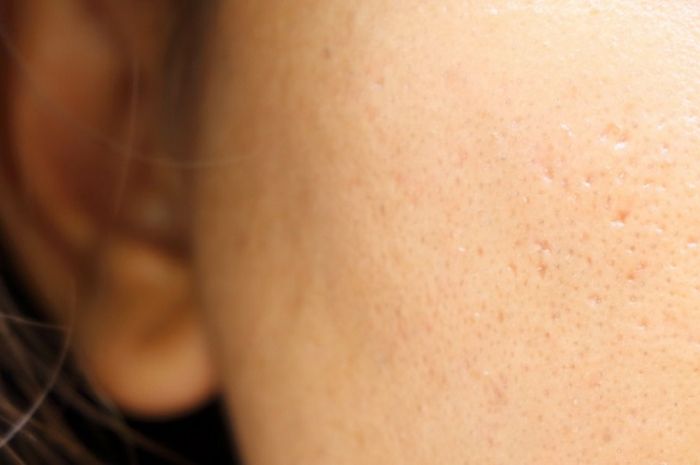 Di Rumah Aja Kecilkan Pori Pori Wajah Yang Membesar Gegara Keseringan Terpapar Sinar Matahari Semua Halaman Otofemale