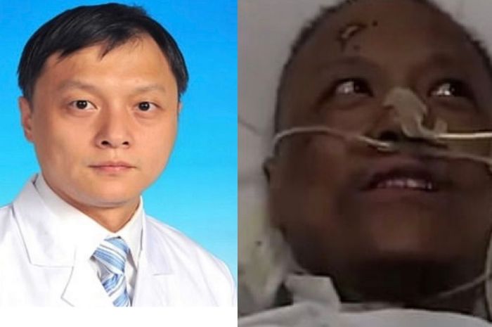 Kulit Dua Dokter di China Berubah Jadi Hitam Setelah Jalani Perawatan Virus Corona 2 658552404