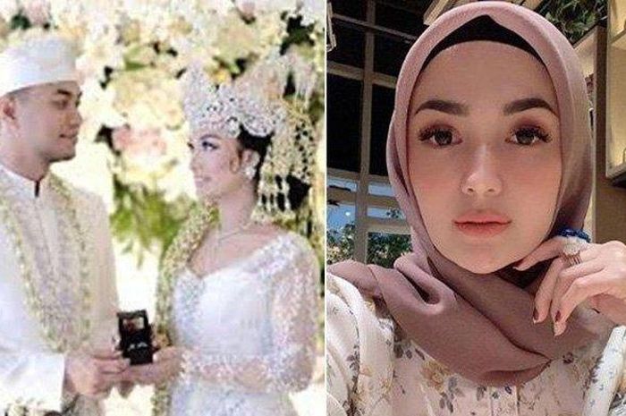 Sungguh Ironi! Mantan Suaminya Tengah Hidup Bahagia bersama Zaskia Gotik, Aktris Cantik Ini Justru Susah Payah Berjuang Melawan Kanker yang Menggerogoti Tubuhnya