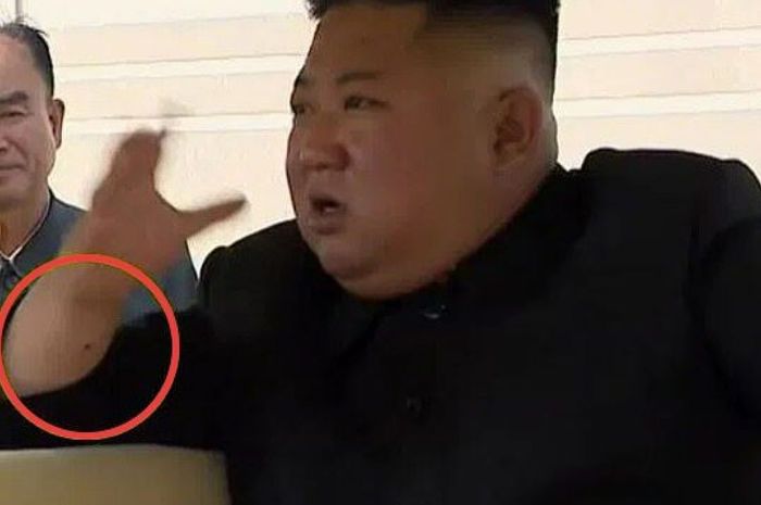 Kim Jong Un