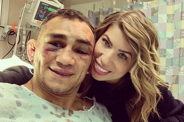 Tony Ferguson (kiri) dengan luka robek dibawah matanya pasca UFC 249 tengah berfoto bersama sang Istri. 