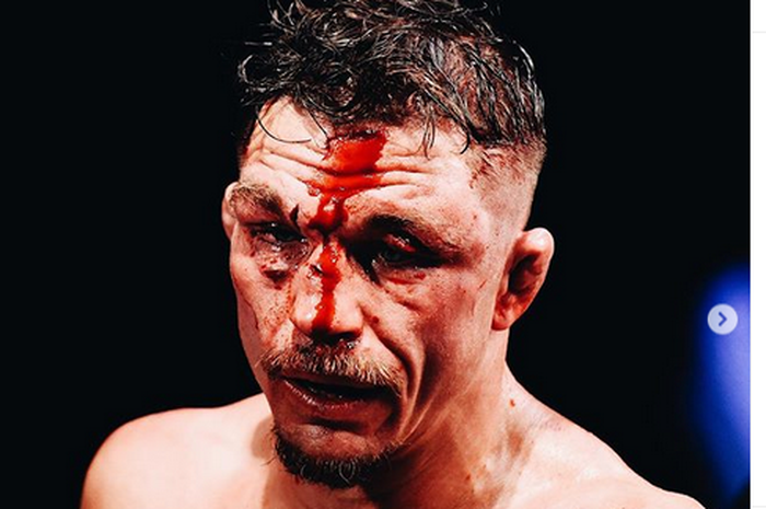 Petarungan antar Darren Elkins melawan Nate Landwehr pada UFC Fight Night 176 (17/5/2020) layak jadi salah satu yang paling berdarah.