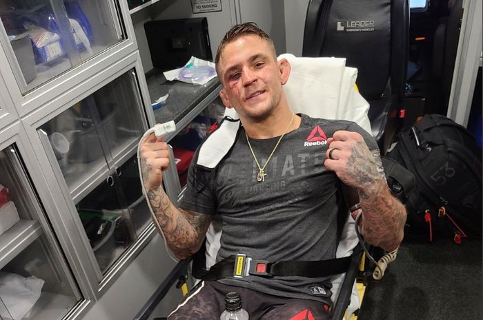 Dustin Poirier, babak belur setelah memberikan suguhan pertarungan dahsyat melawan Dan Hooker di UFC Vegas 4, Sabtu (27/6/2020).