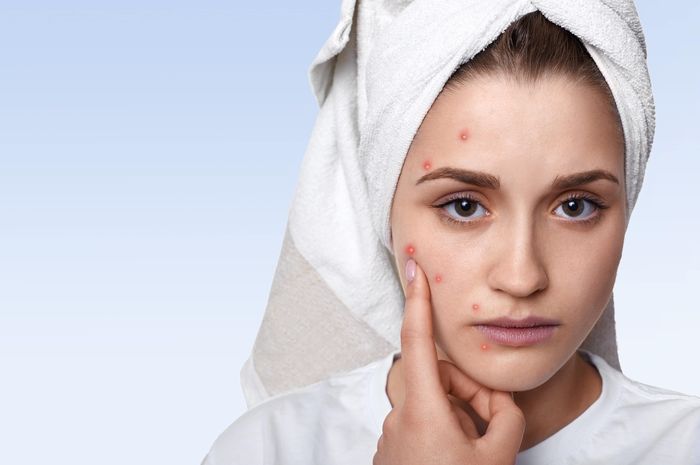Anti Ribet Cuma Ada 5 Skincare Yang Wajib Dipakai Remaja Berjerawat Semua Halaman Stylo Anti Ribet Cuma Ada 5 Skincare Yang Wajib Dipakai Remaja Berjerawat Semua Halaman Stylo