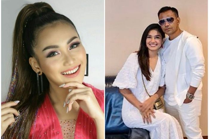 Ayu Ting Ting Goyang sampai Angkat-Angkat Kaki di Depan Judika, Istri