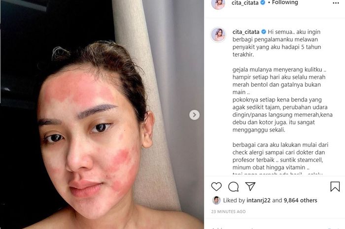 Citacitata Sakit