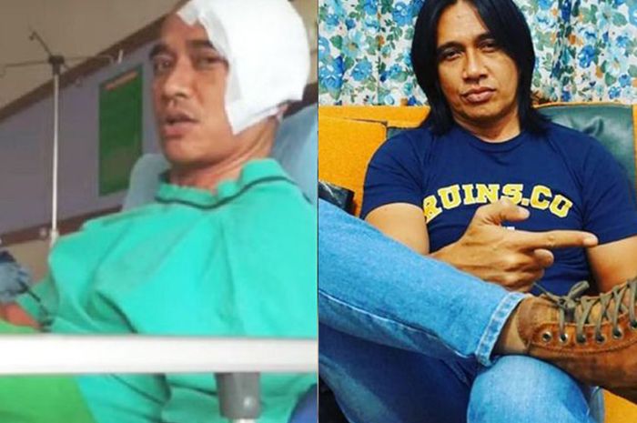 Sebelum Meninggal Karena Kanker Otak, Agung Hercules Ternyata Wanti