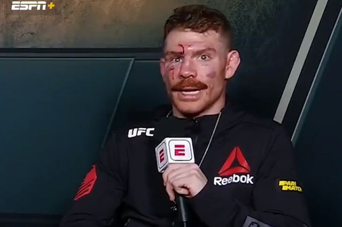 Petarung UFC, Paul Felder, setelah bertarung melawan Rafael dos Anjos, Sabtu (14/11/2020).