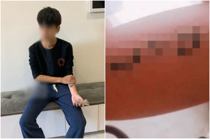 Remaja 16 tahun yang tato nama pacarnya sebagai bukti cintanya abadi tapi seminggu kemudian putus.