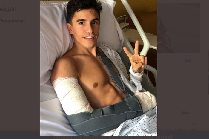 Marc Marquez usai menjalani oeprasi ketiga di Rumah Sakit Ruber Internacional, Madrid, Spanyol.