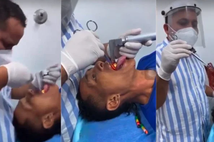 Seorang pria nyaris tewas karena ikan kecil nyangkut di tenggorokannya.