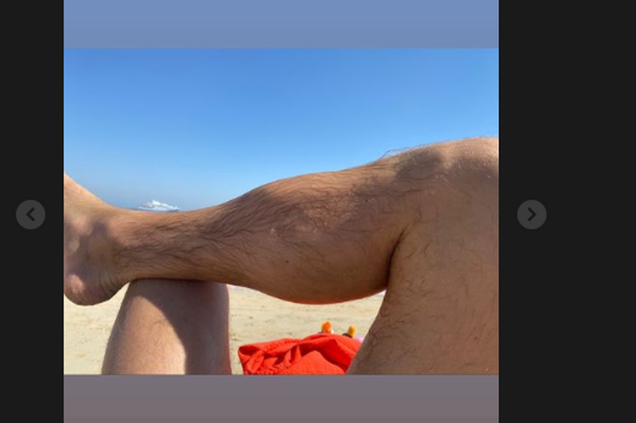 Conor McGregor menunjukkan kaki bengkaknya dalam unggahan story Instagramnya Jumat (5/2/2021)