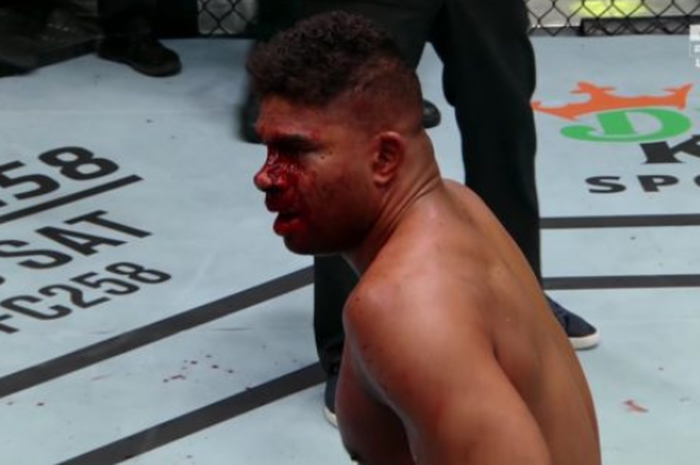 Momen Alistair Overeem duduk tak berdaya di tengah oktagon pada UFC Vegas 18 (7/2/2021).