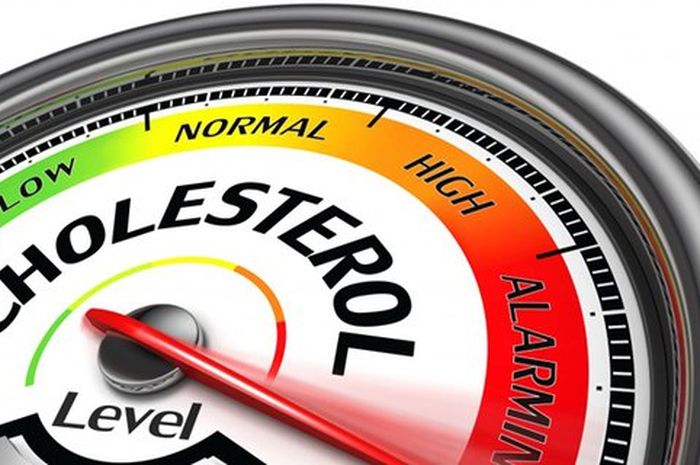 Kolesterol tinggi berisiko menyebabkan penyakit serius.
