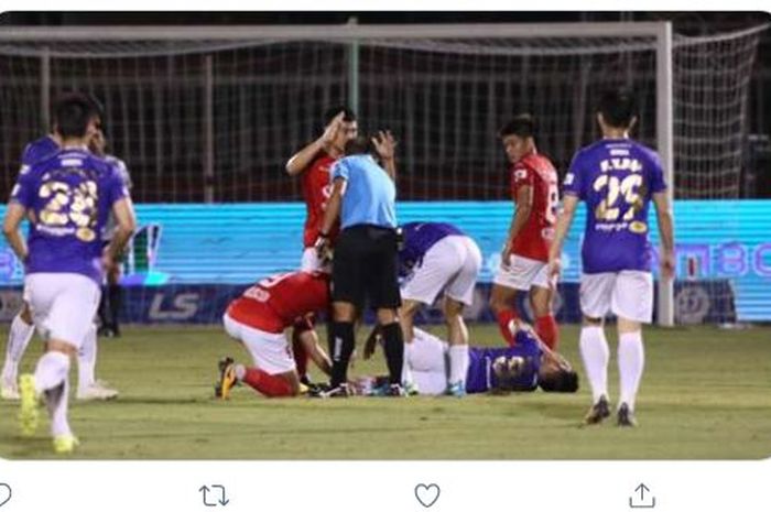 Gelandang Hanoi FC dan timnas Vietnam, Do Hung Dung, mengalami cedera horor pada Selasa (23/3/2021).
